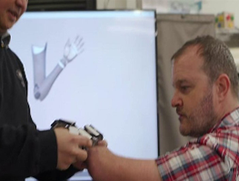 The ‘mind-bending’ bionic arm powered by AI